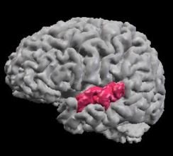 Affected part of the brain in the schizotypal personality disorder