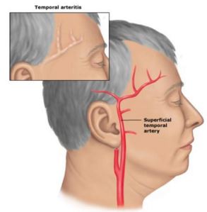 Anatomy of the temporal artery