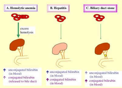 Mechanism of Bilirubin in urine