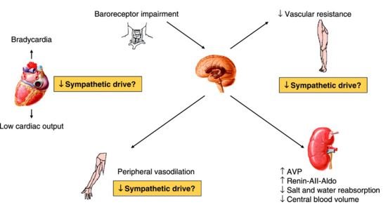 Overview of altered vasovegal syncope