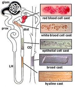 Possible cells in urine