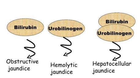 Clinical significance of Urobilinogen in urine