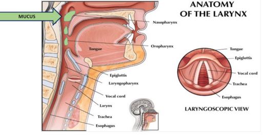 Larynx affected with mucous
