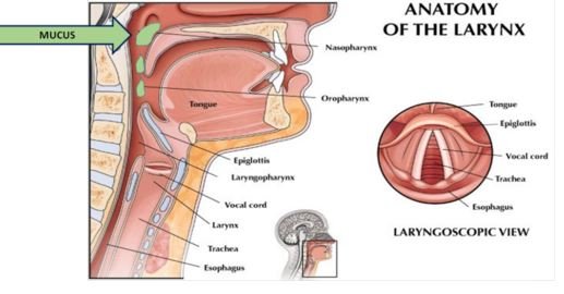 What is phlegm in the throat?