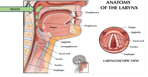 Mucus Stuck In Throat Causes Treatment Prevention