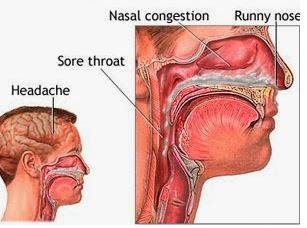 What is phlegm in the throat?