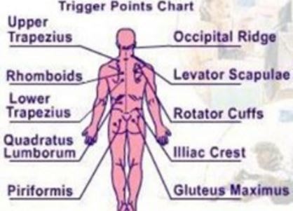 trigger point injections chart