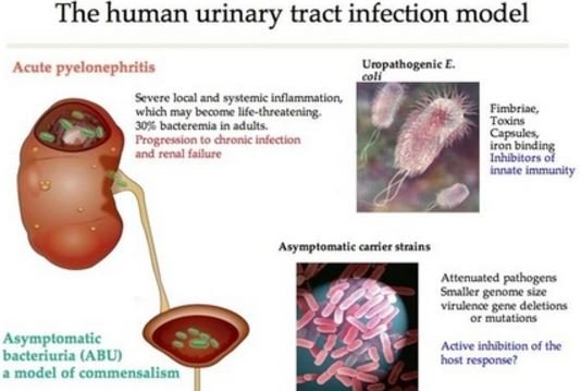 urosepsis causes