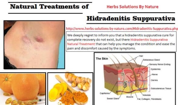 How to heal hidradenitis suppurativa