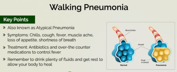 walking pneumonia signs