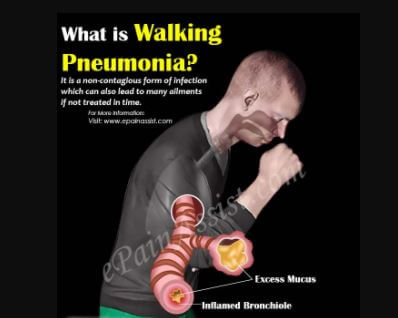 Walking pneumonia