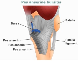 Pes Anserine Bursitis Treatment Symptoms Images Causes