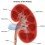 Caliectasis - Definition, Treatment, Symptoms, Causes